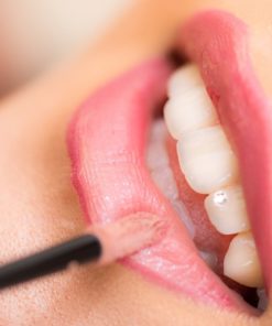 Labial