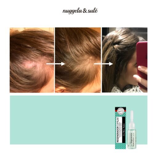 Αμπούλα Nuggela Sule Hair Regenerator 1x10ml 3