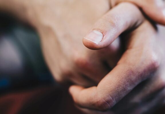 Consejos para evitar las molestas pieles en las uñas